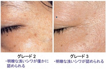 【リペアジェル】が載った雑誌(医学誌)について